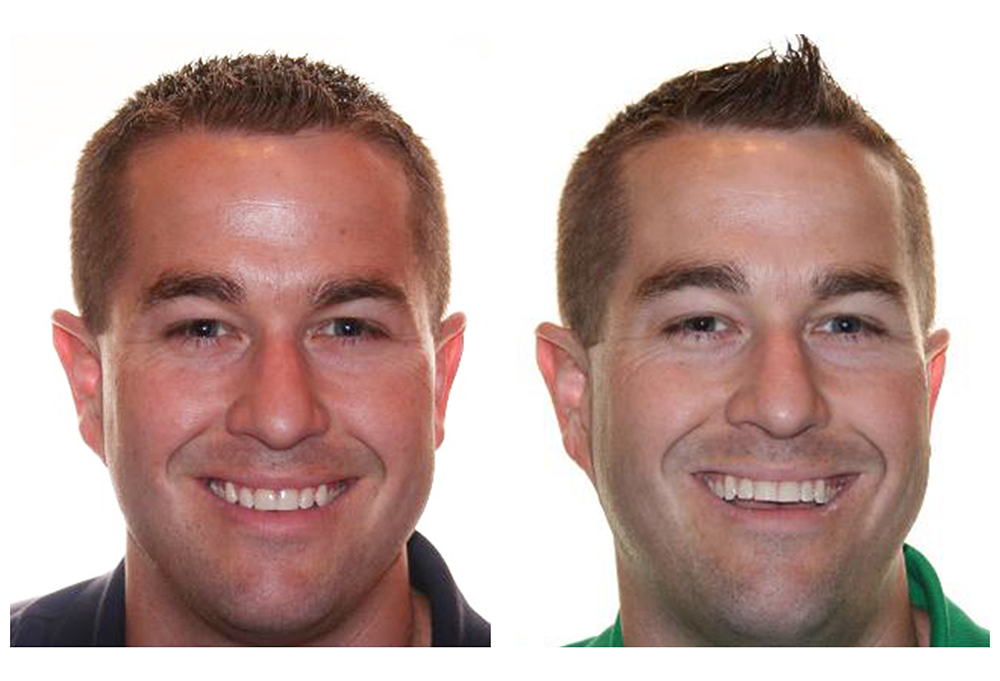 Carroll Family and Cosmetic Dentistry