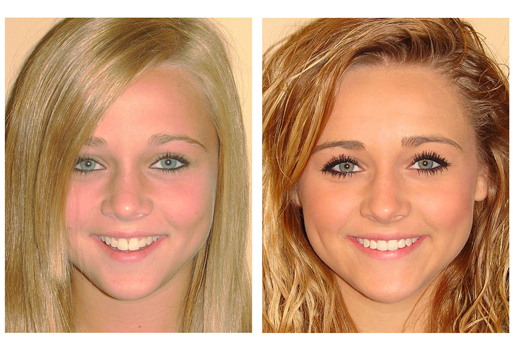 Carroll Family and Cosmetic Dentistry