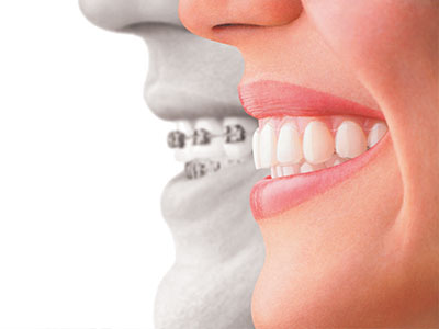 Carroll Family and Cosmetic Dentistry