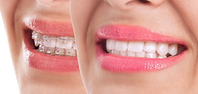 Carroll Family and Cosmetic Dentistry